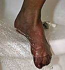 Wet foot